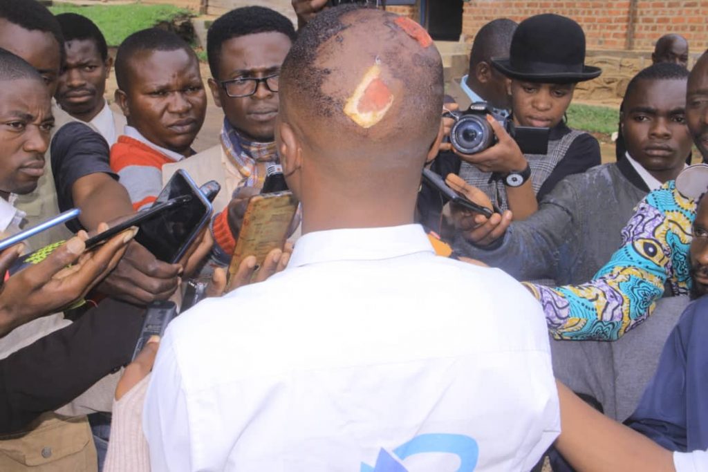 Butembo: Delphin Nzanzu Sindani journaliste à la RTGL et correspondant de Digital Congo échappe à la mort la nuit du dimanche 7 Mai 2023