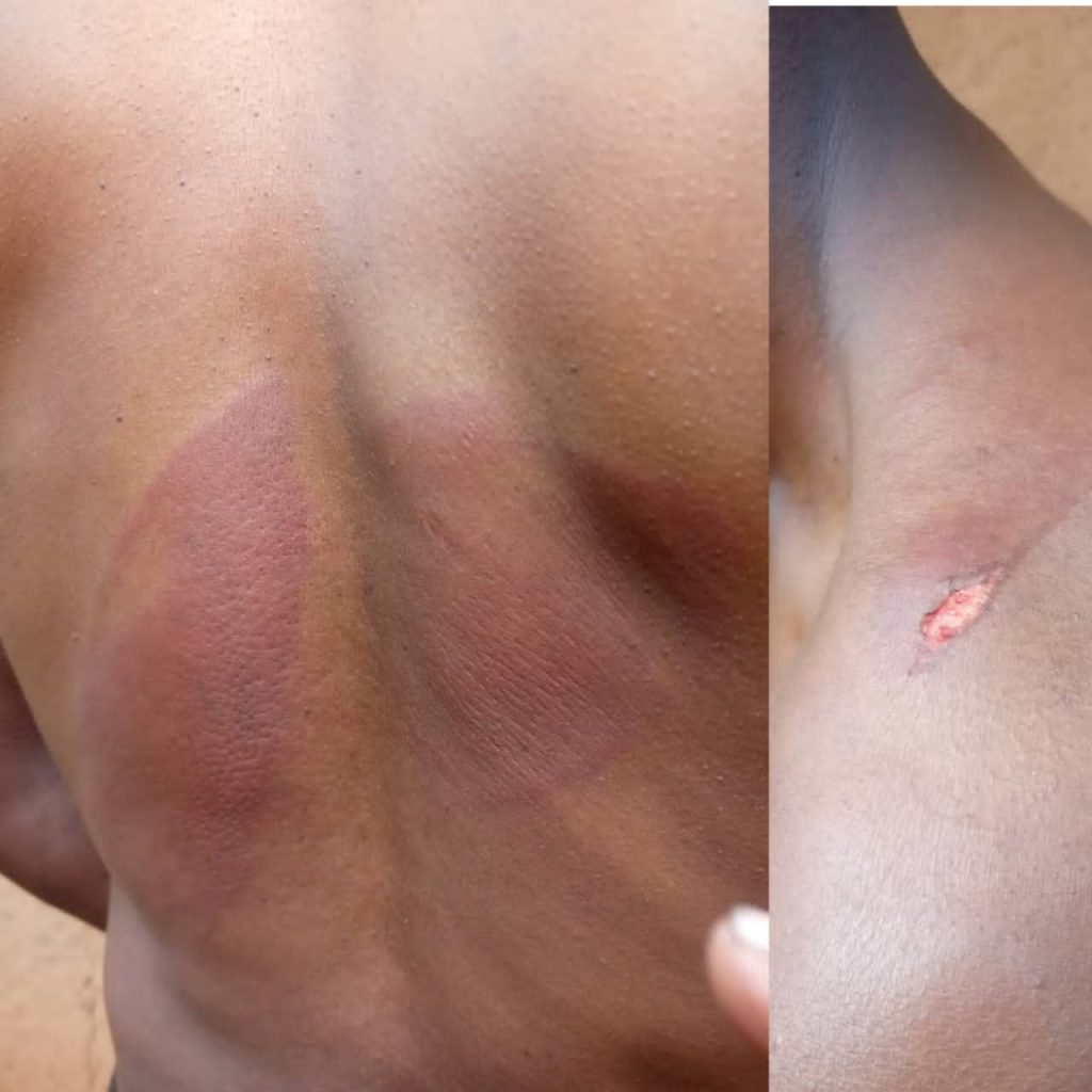 Butembo : des inconnues armées font irruption en cellule Mihake et blessent monsieur SOMO par armes blanches